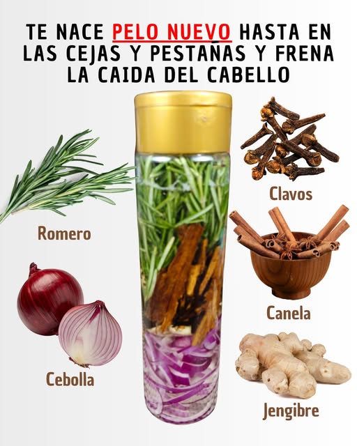 Shampoo Natural para Frenar la Caída y Fortalecer el Cabello 🧅🌿