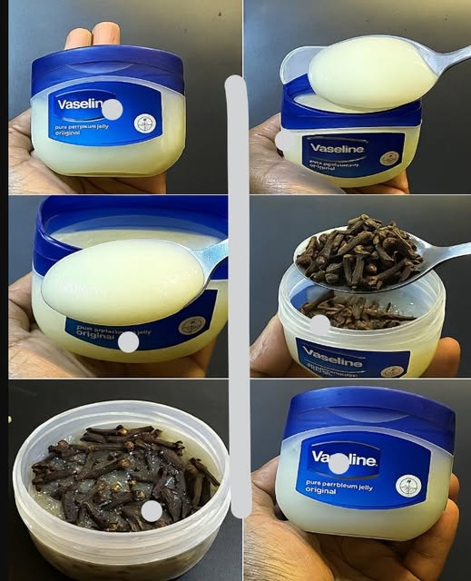 Mélange Clous de Girofle & Vaseline : Le Secret Beauté et Santé Révélé