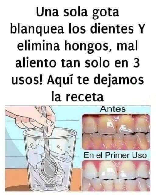 Cómo Quitar el Sarro y Blanquear tus Dientes de Forma Segura